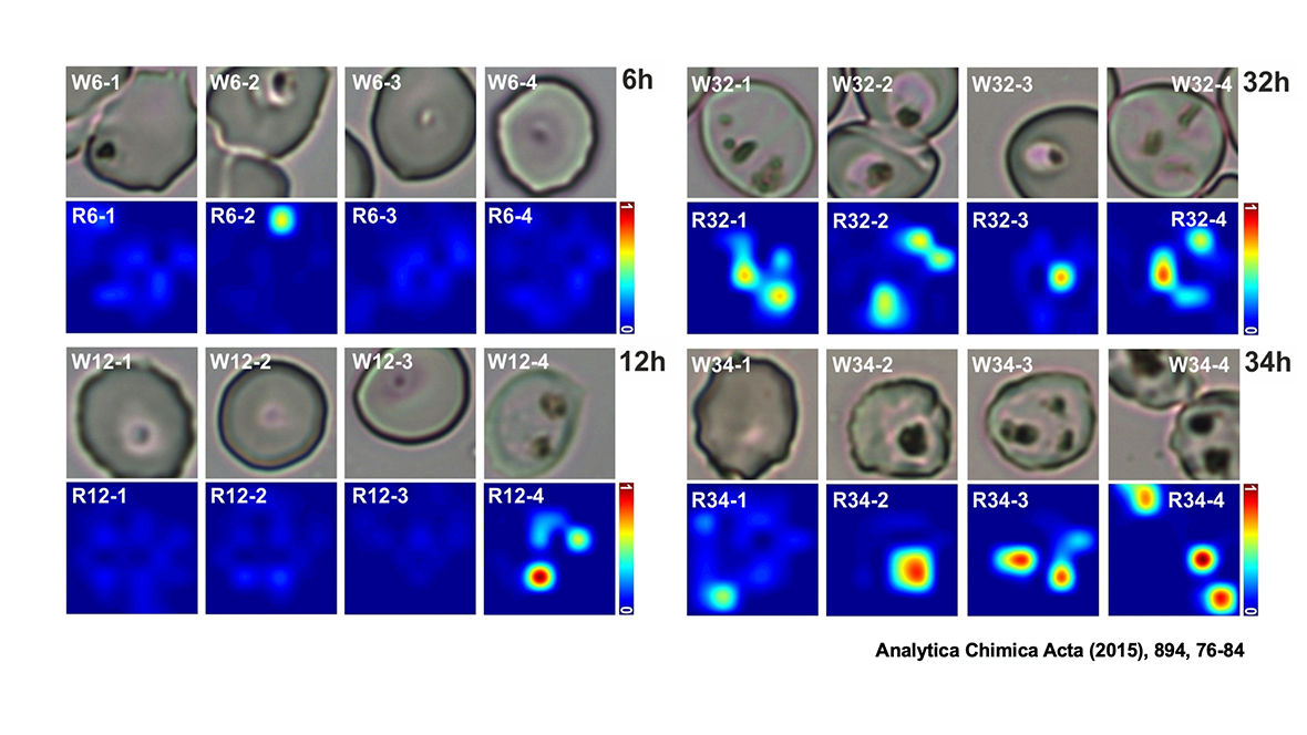 Imaging of the malaria pigment hemozoin